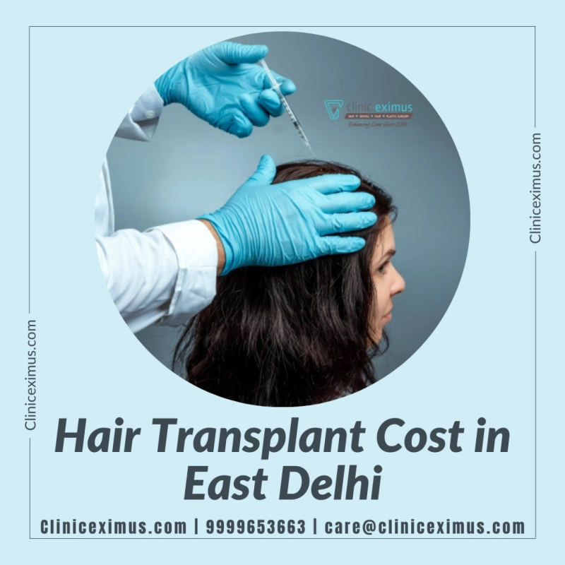 Hair Transplant Cost in East Delhi And Options And Procedures