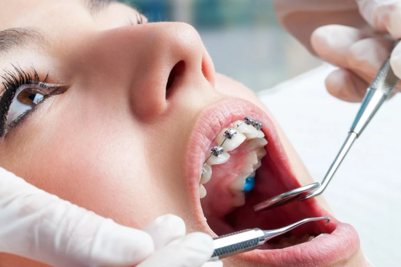 Unveiling Best Orthodontic Clinics and Dentists in Dubai