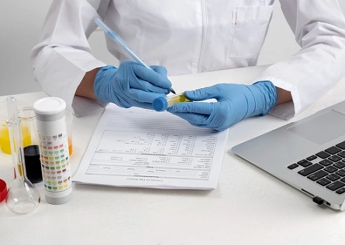 What are Cut-off Levels in Drug Tests: An Insightful Guide!