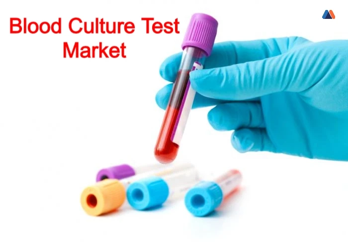 Everything You Need To Know About The Blood Culture Test