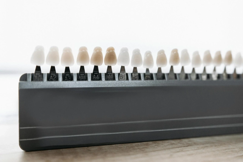 Achieve the Ultimate Smile Makeover with Dental Implants and Dental Veneers