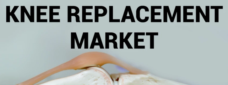 Knee Replacement Market, by Demand Analysis, Regions, Risk Analysis, Driving Forces and Application, Forecast to 2027.