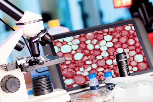 Stereotactic Surgery Devices Market 2020 Top Key Players And Industry by End-User Segments Forecast Till 2030