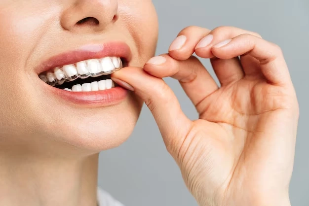 Unmasking the Dark Side of Invisalign Braces: Myths and Realities