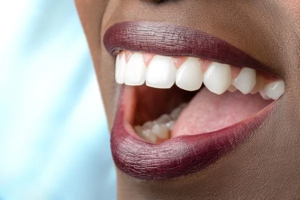 The Benefits of a Whole Mouth Restoration and Questions to Ask Your Dentist