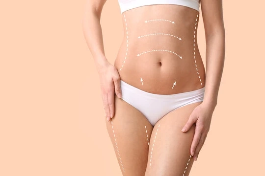 What to Expect During a Liposuction Consultation