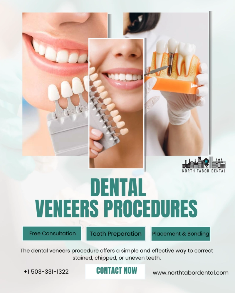 Are Denture Veneers Permanent or Removable?