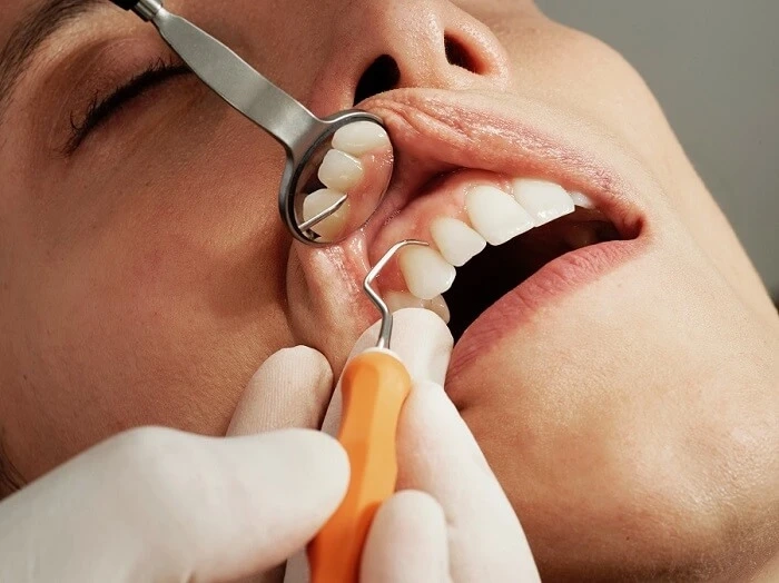 Understanding Dental Restorations: Restoring Your Smile and Oral Health