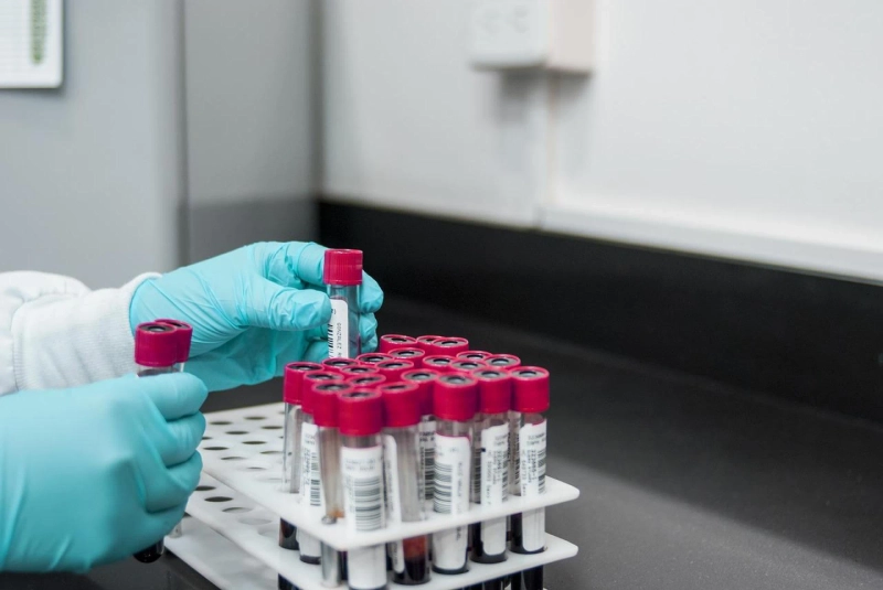 5 Blood Tests Every Vegan Should Get