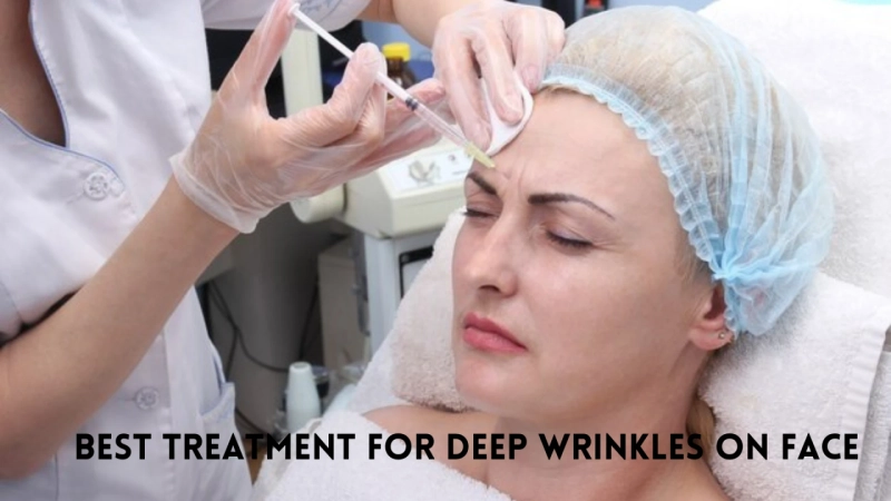 Best Treatment for Deep Wrinkles on Face