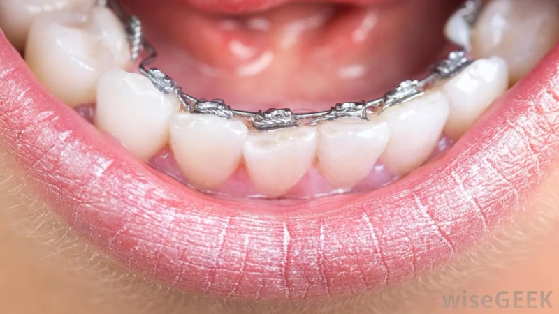 How to Find the Best Affordable Orthodontist Near Me
