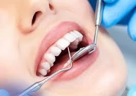 The Ultimate Checklist Before Getting Full Mouth Dental Implants