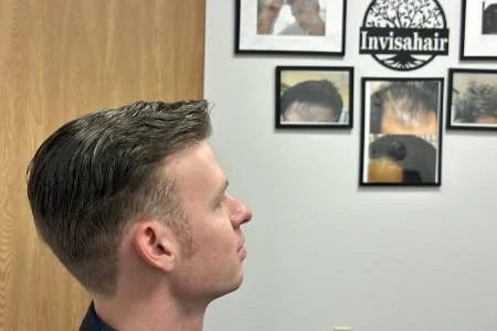 Common Misconceptions About Hair Loss