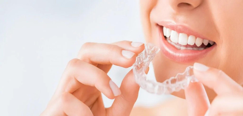 What to Look for When Selecting an Invisalign Specialist?