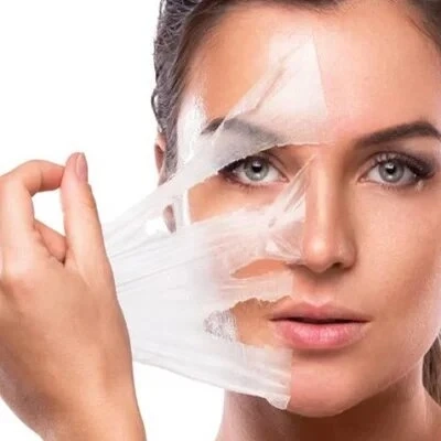 Chemical Peels for All Ages: Tailoring Treatments to Your Skin