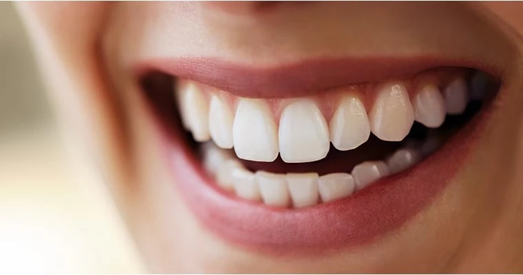 What is Full Mouth Restoration?