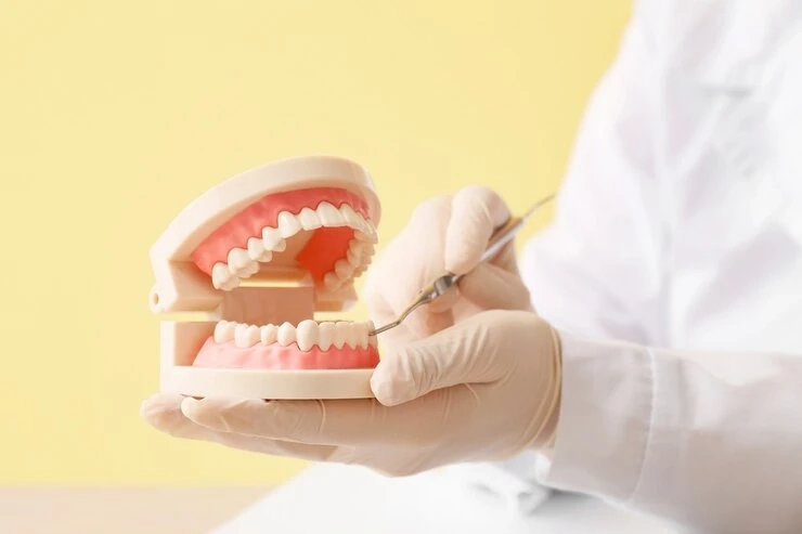 How Many Types of Dental Implants Are There and Do You Need One?