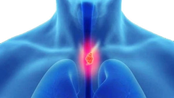 Laparoscopic Esophageal Surgery in Delhi: Precision Care for Complex Esophageal Disorders