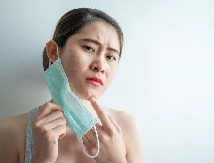 A simple, effective way to treat acne without head