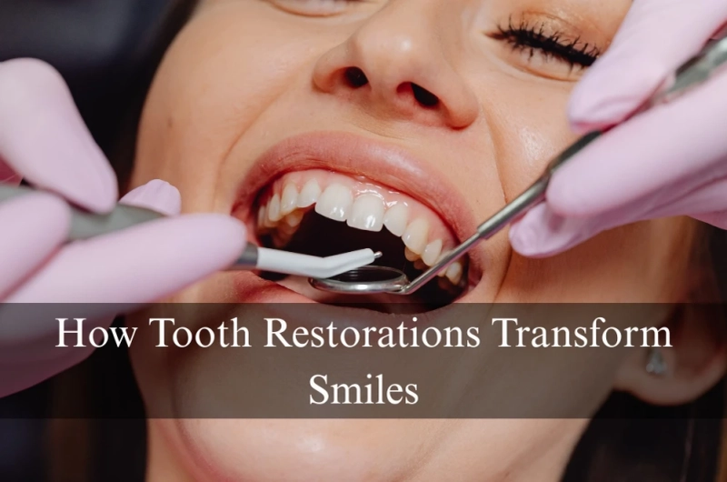 How Tooth Restorations Transform Smiles
