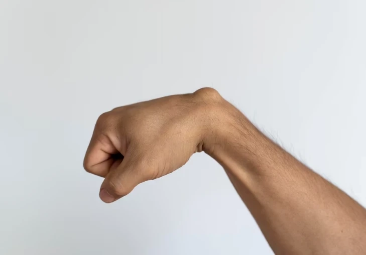 Lipoma Removal at Home: How to Reduce Fatty Lumps Naturally