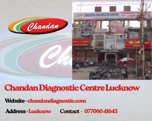 Chandan Diagnostic Centre Lucknow – Your Trusted Partner in Quality Healthcare