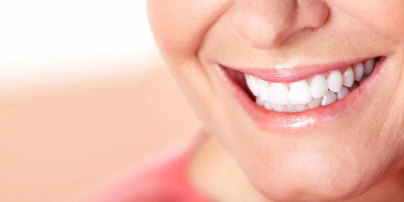 Full Mouth Dental Implants