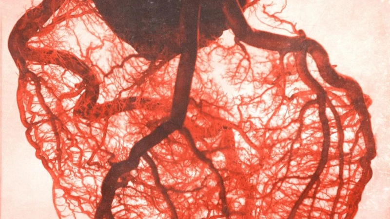 Experiencing Chest Pain? Here's what to do