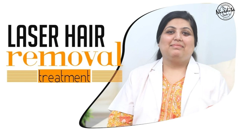 Top 5 Benefits of Laser Hair Removal