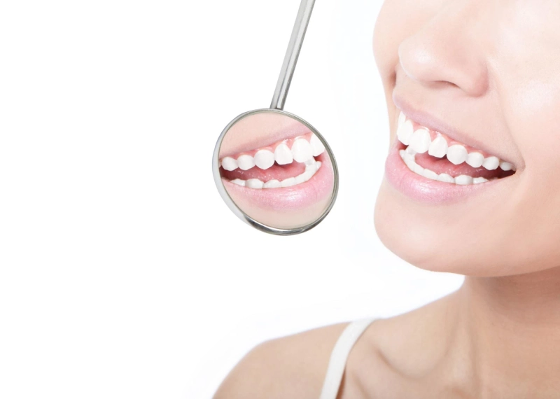 How Teeth Whitening Can Enhance Your Smile?