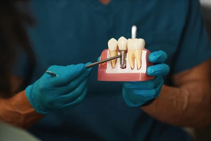 How Modern Dentistry Makes Dental Implants in Derby Pain-Free