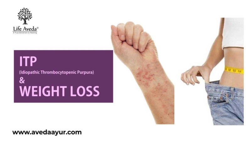 ITP and Weight Loss