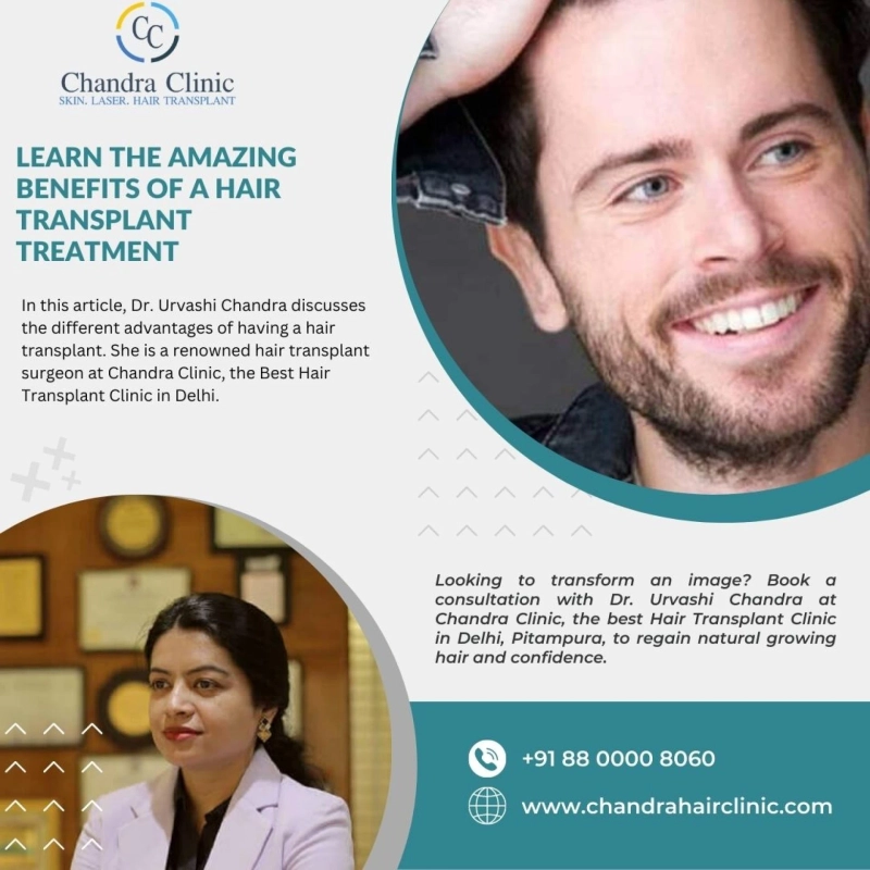 Learn the Amazing Benefits of a Hair Transplant Treatment