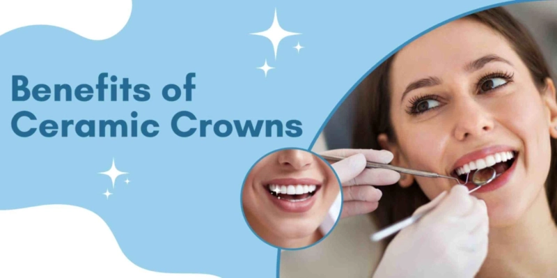 Smile Confidently: The Beauty and Benefits of Ceramic Crowns