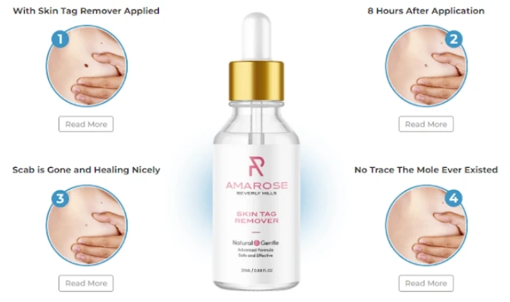 Amarose Skin Tag Remover Review - Know Why People Getting Crazy For It! Price