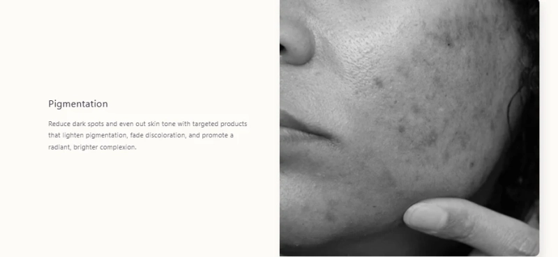 Pigmentation | Best Skincare Brand in India