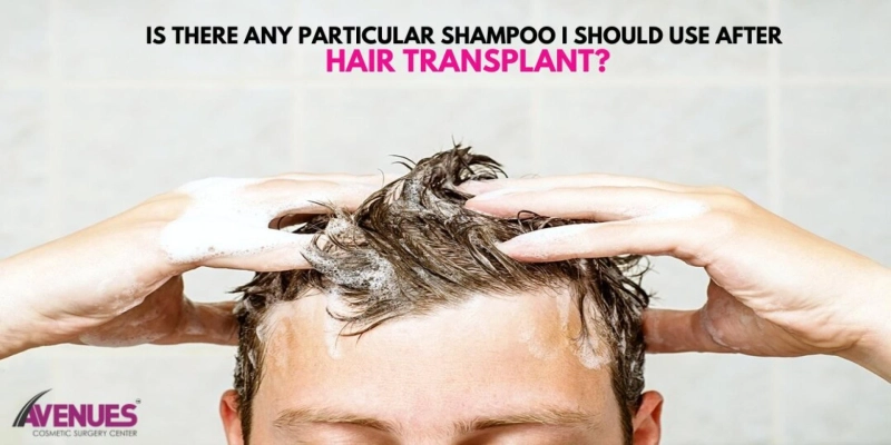 Is there any particular Shampoo I Should use after Hair Transplant?