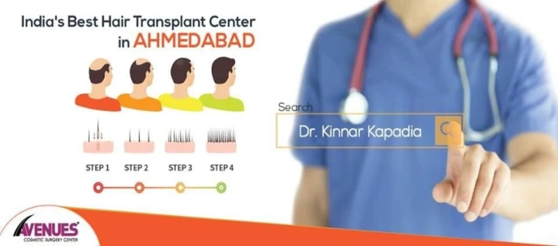 Best Hair Transplant in Ahmedabad- Hair Transplant in Ahmedabad