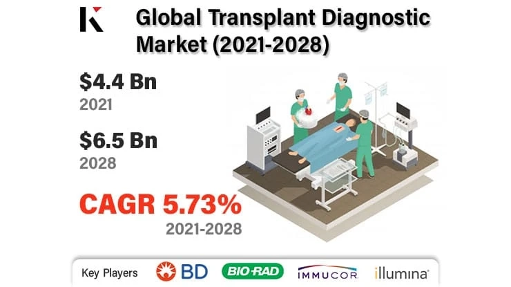 Transplant Diagnostic Market 2022 By Top Manufacturers, Growth, Trends, Size, Share, Analysis and Forecast to 2028.