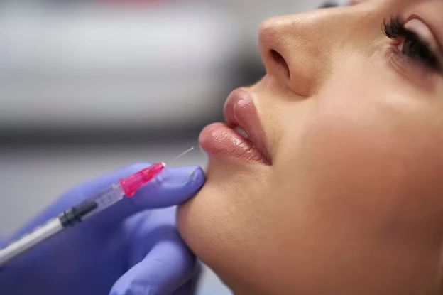 Lip Augmentation for a Youthful Look: How It Works