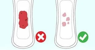 Mau bao thai la gi Khac voi doa say thai nhu the nao