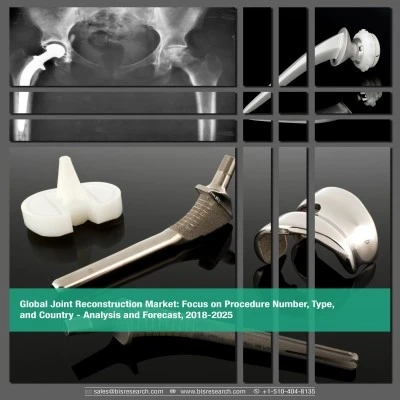 Joint Reconstruction Market is Forecast to Surpass $26.81 billion by the end of 2025