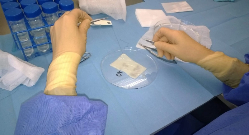 Amniotic Membrane Market Size, Growth, Leading Companies and Industry Report 2023-2028