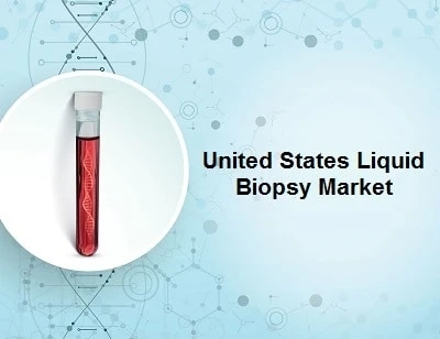 United States Liquid Biopsy Market to be Dominated by Multi-Gene Parallel Analysis Technology till 2027 | TechSci Research