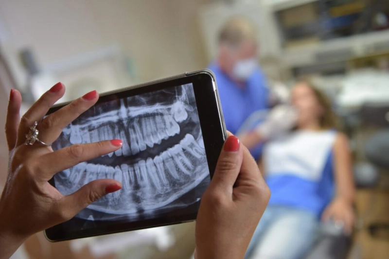 Experience Smooth Tooth Extractions in Nashville TN