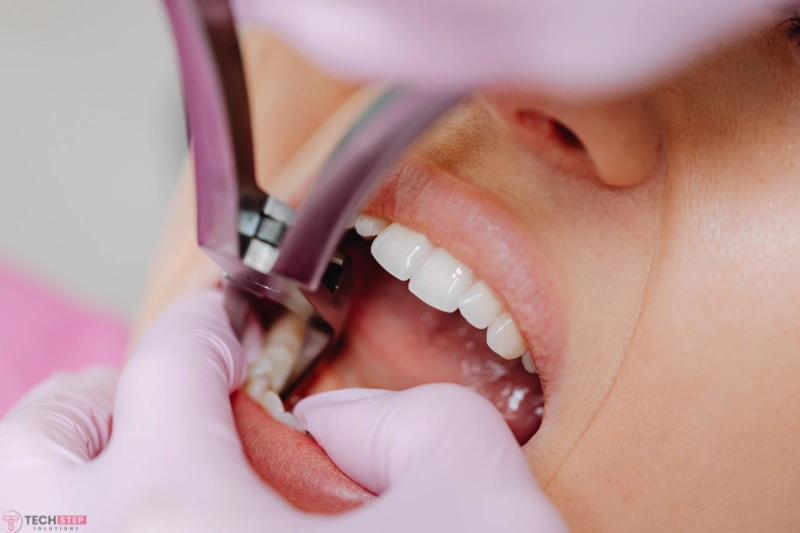 Are Dental Sealants Safe? Everything Parents and Patients Should Know
