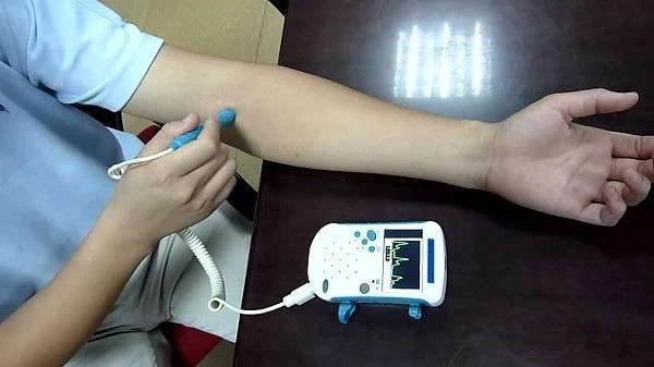 Key Players in the Blood Flow Measurement Devices Market and Their Impact on the Industry