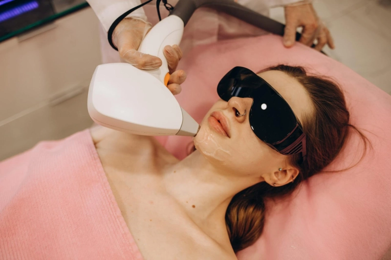 Microneedling Chino Hills: Transform Your Skin at Harmony Aesthetics