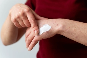 Competitive Landscape and Key Players in the Wound Biologics Market