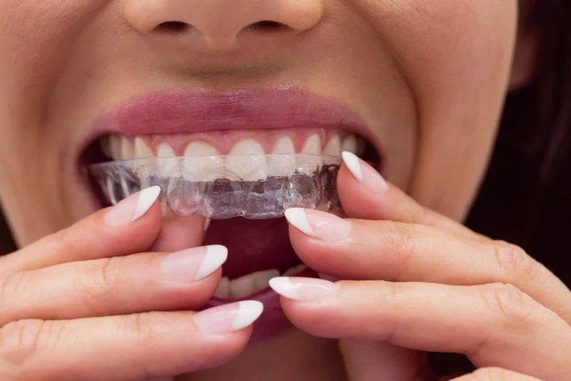 Dental Clinic in Goregaon East Mumbai